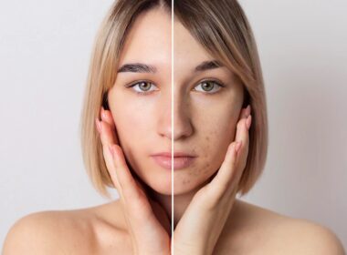 Jaki jest najlepszy sposób na oczyszczanie twarzy?
